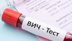 Что нужно знать и ВИЧ-инфекции: основные стадии ее развития